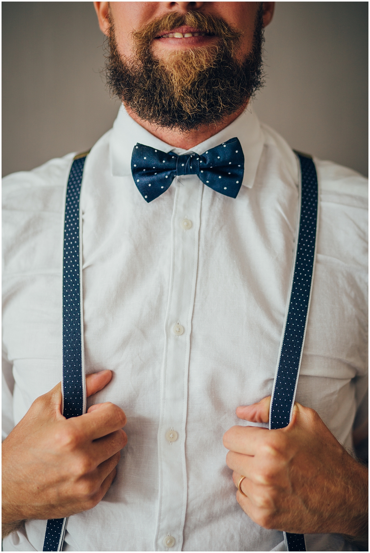 Groom wearing braces and a bow tie